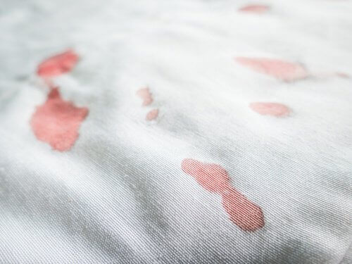 beyaz kumaş üzerinde kan lekeleri