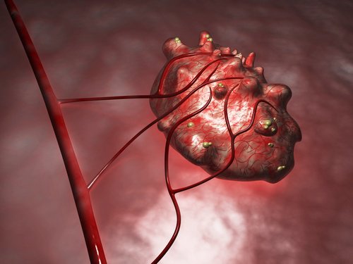 yumurtalık kistleri