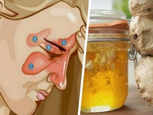 Doğal Yöntemlerle Sinüzit Tedavisi