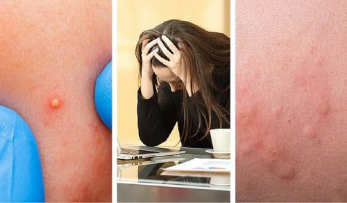 Dikkat, Stres Seviyeniz Yüksek Olabilir!