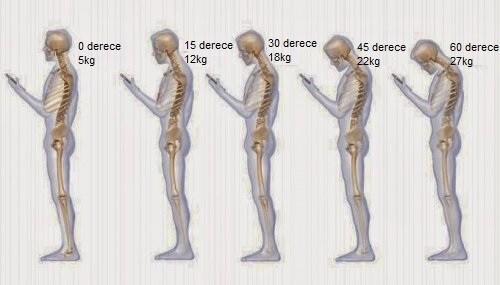 Boyun Ağrısına Neden Olabilecek 6 Alışkanlık