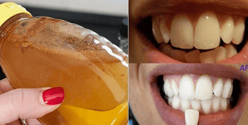 Tamamen Doğal Bir Malzeme ile Diş Beyazlatma
