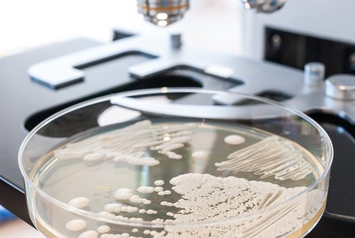 Candida Mantarı Oluşumunu Engellemek İçin 10 Yiyecek