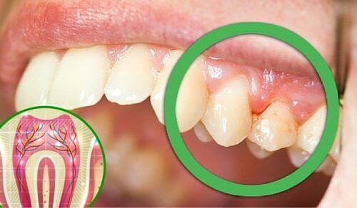 Diş Ağrısına Yol Açabilecek 6 Neden