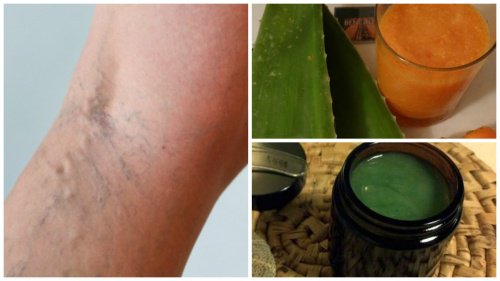 Eskilerin Kullandığı Varis Tedavisi