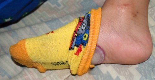 Ayakların Altına Soğan Koyarak Uyumak Ne İşe Yarar?