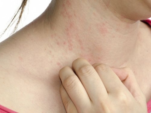 Diyabetin Az Bilinen Belirtilerini Duyunca Şaşıracaksınız!