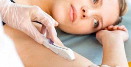 deri altına implant yerleştirilen kadın