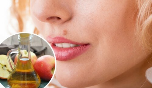 Doğal Yollarla Benleri Ortadan Kaldırın