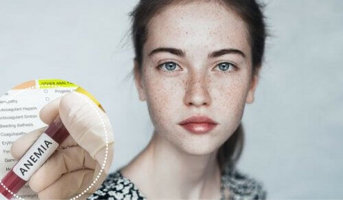 Anemi Duyguları Nasıl Etkiler? Öğrenin!
