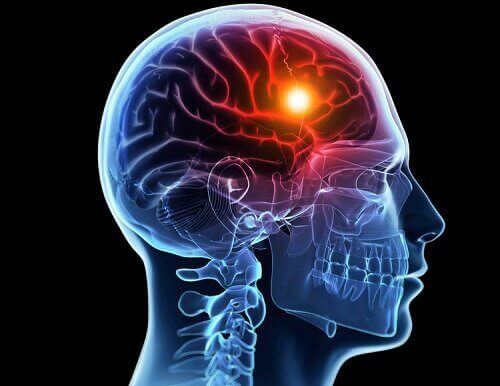 Beyin Felci Öncesinde Vücudun Verdiği 8 Uyarı