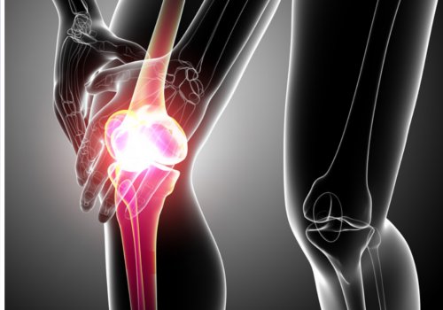 diz röntgeni tendinit