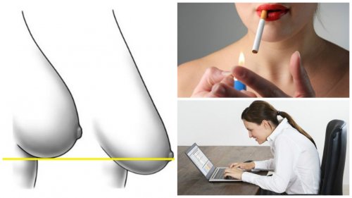 Sarkan Göğüsler İstemiyorsanız Bunlardan Kaçının!