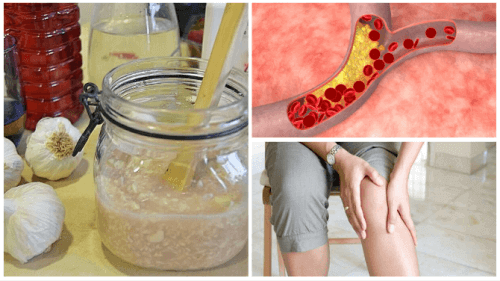 Bu Şurup İle Kötü Kolesterol Ve Eklem Ağrısını Azaltın