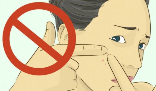 sivilcelerinizi sıkmayın