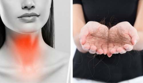 Tiroide Bağlı Saç Kaybını Önlemek İçin Yapılabilecek 8 Şey