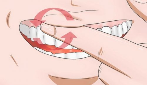 Diş Eti Şişmesi için 8 Tedavi Yöntemi