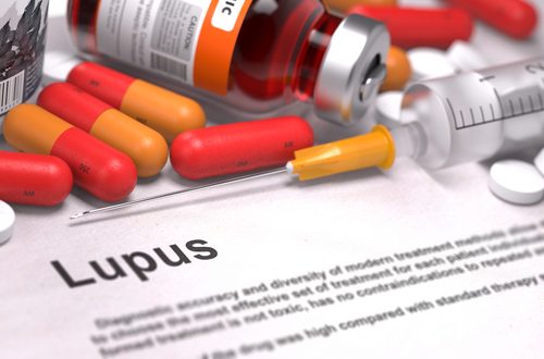 lupus nedir