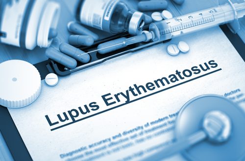 Lupus Eritematosus