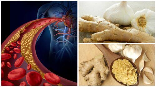 Ev Yapımı Zencefil ve Sarımsak Tedavisi ile Yüksek Tansiyon ve Kolesterolle Savaşın