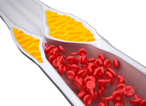 Kolesterol Seviyenizi Kontrol Etmek için 4 Smoothie