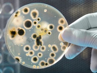 petri kabında bakteri kolonisi