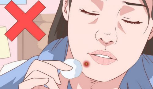 Çenedeki Sivilceler İçin Doğal ve Etkili Tedavi