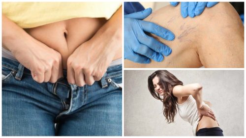 Dar Kıyafetler Giymek Hangi Sorunlara Yol Açar?