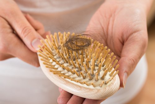 Doğum sonrası alopesi yaşayan kadının fırçada kalan saçları