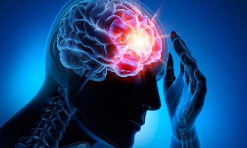 En Yaygın Beyin Damar Hastalıkları