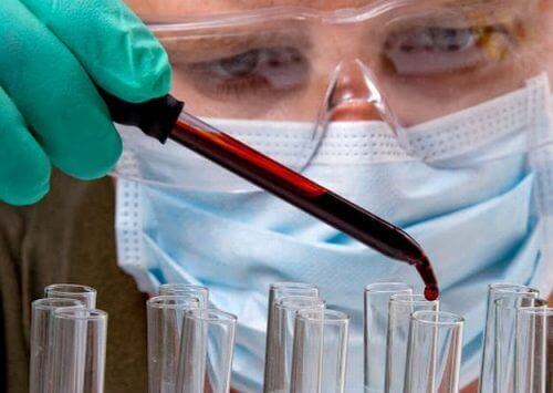 Basit Bir Kan Testi Tümörün Yerini Tespit Edebilir