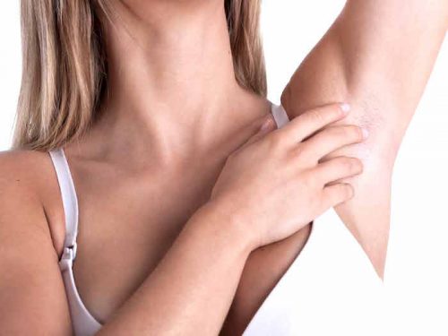 döküntü olan kadın