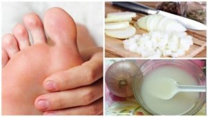 Sert Ayaklar İçin 2 Etkili Doğal Çözüm