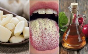 Candida Mantarı: Çoğalmasını Önlemek için Yöntemler
