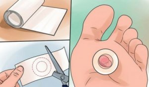 Su Toplayan Bölgeyi Tedavi Etmek İçin 9 Ev Reçetesi