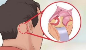 Dünyadaki En Kötü Ağrı Trigeminal Nevralji Hakkında Bilinmesi Gereken 5 Şey