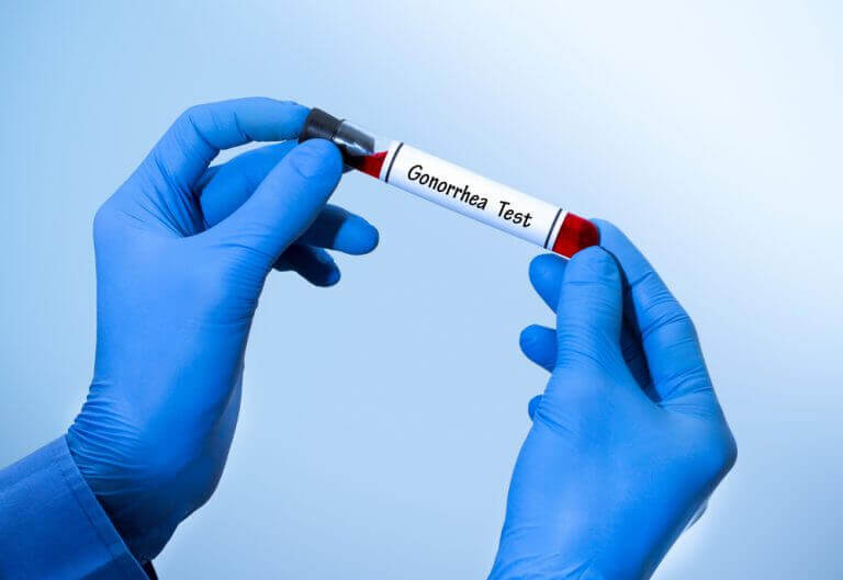 bel soğukluğu testi