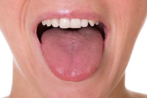 Dil Kanseri ile İlgili Olabilecek İlk 5 Semptom