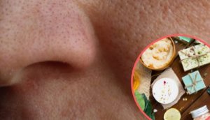 Geniş Gözenekleri Küçültmek için 8 Ev Tedavisi