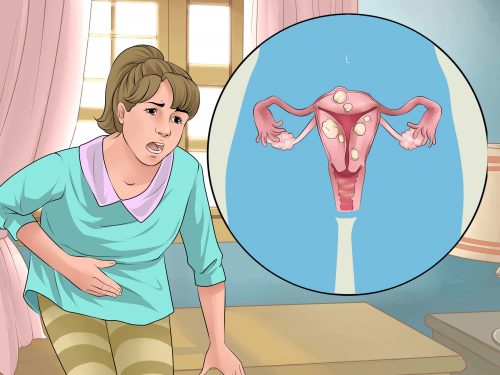 Menstrüel Kramplar için Doğal Tedaviler