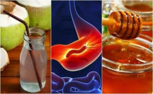 Gastrit İçin Bu Mükemmel Doğal Reçeteleri Deneyin