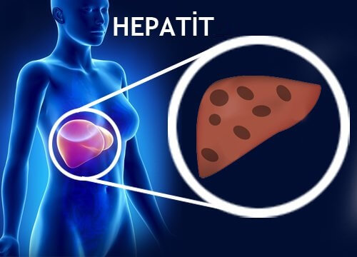 karaciğer ve hepatit