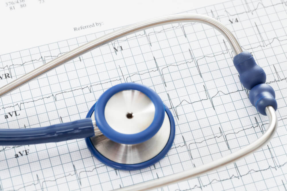 EKG ve antiaritmikler ile tedavi