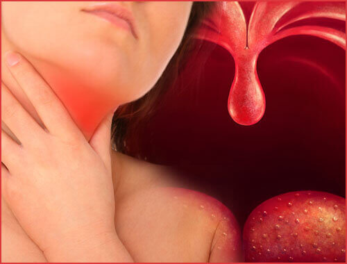 boğazda ağrı ve farenjit