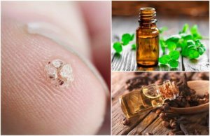 Siğillerden Kurtulmanıza Yardımcı 7 Esansiyel Yağ