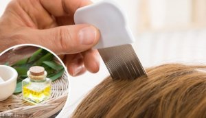 Bitten Kurtulmak için 6 Doğal Yöntem