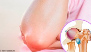 Bursit (Bursitis) Hakkında Bilmeniz Gereken Her Şey