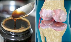 Kemikleri ve Eklemleri Güçlendirmenin Yolları