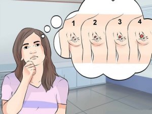 Meme Kanserinin Farklı Türleri, Belirtileri ve Tedavisi