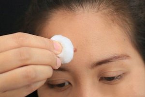 Yüzünüzdeki Sivilcelerin Size Anlatabileceği 6 İç Problem